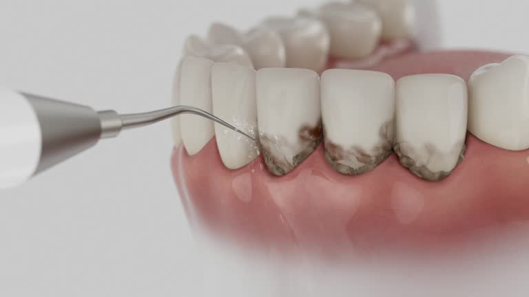 Reliable Dental Implants contractor in Apalachicola, FL by Smile Center Dentistry